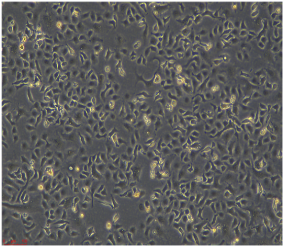 ���ѳ�����(x��)��TOV-21G 